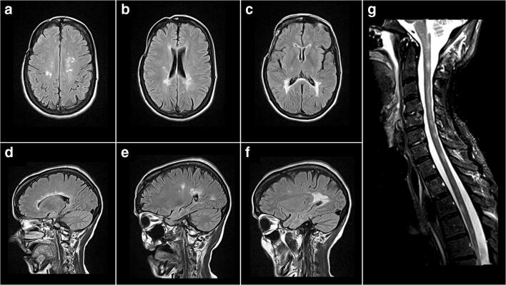 Fig. 3