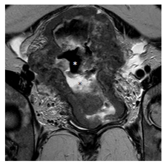 Figure 13