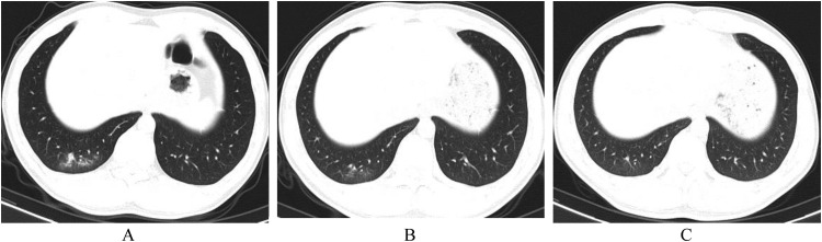 Fig. 2