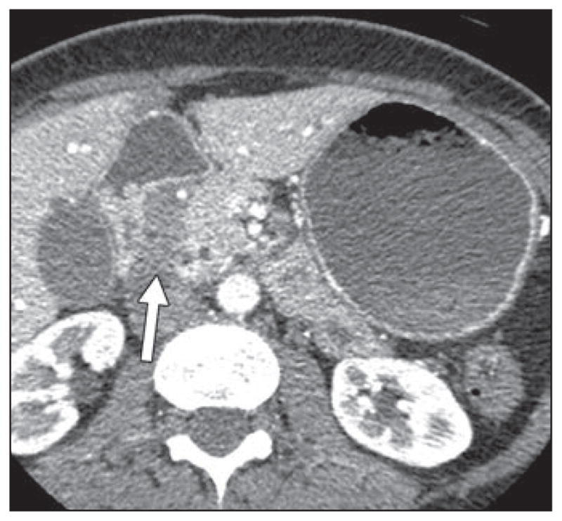 Fig. 10