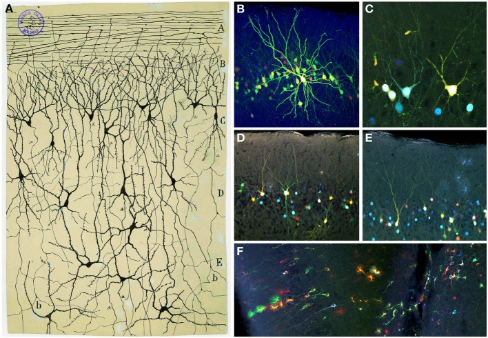 Figure 11