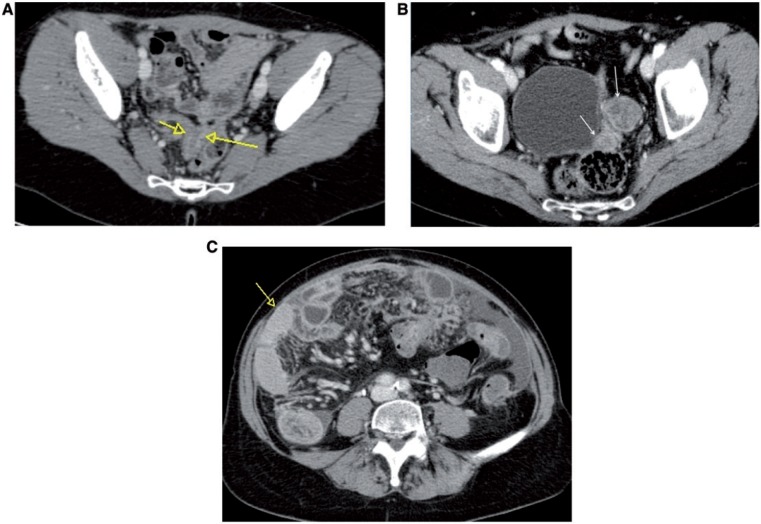 Figure 22