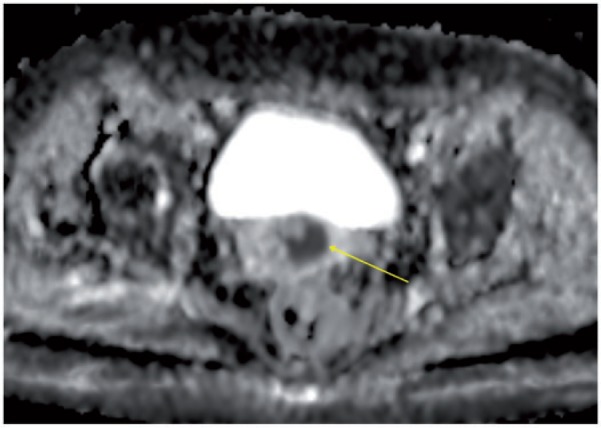 Figure 23