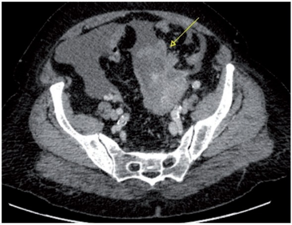 Figure 20