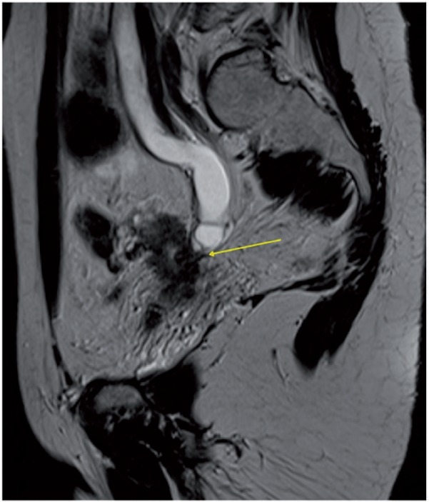 Figure 27