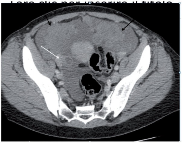 Figure 21