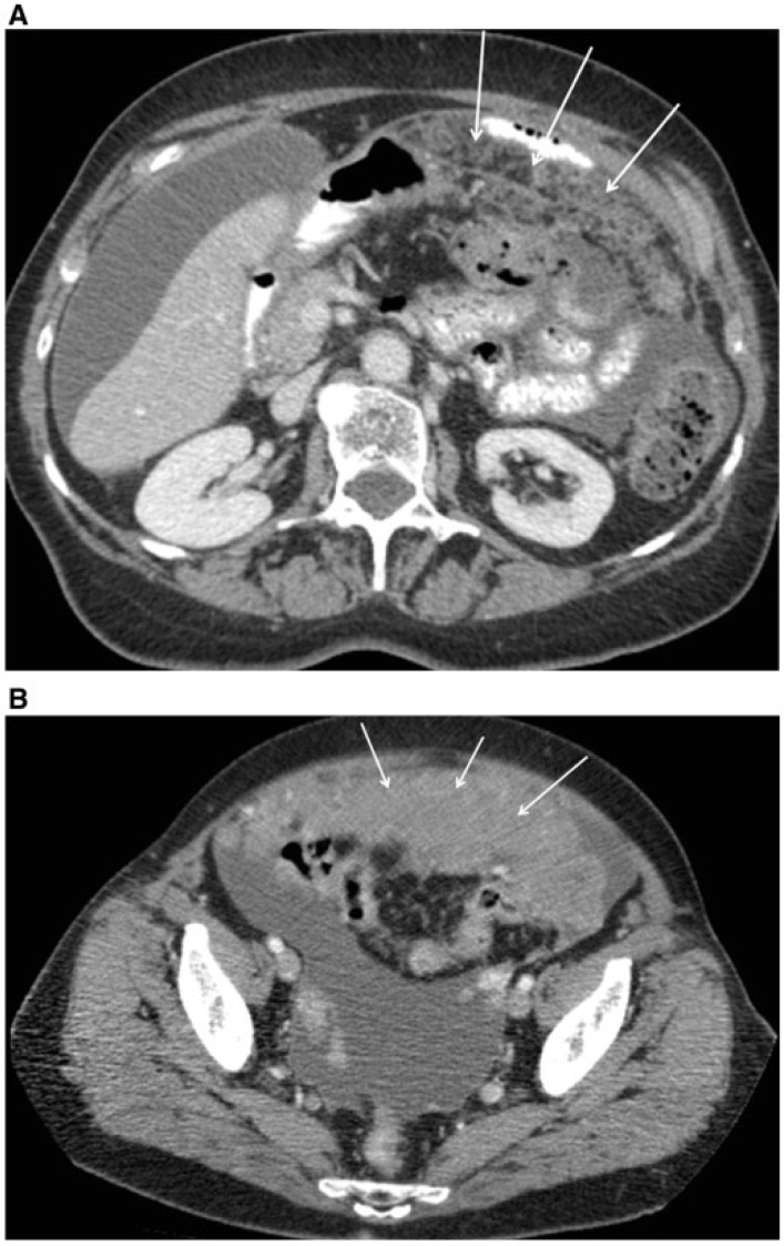 Figure 16