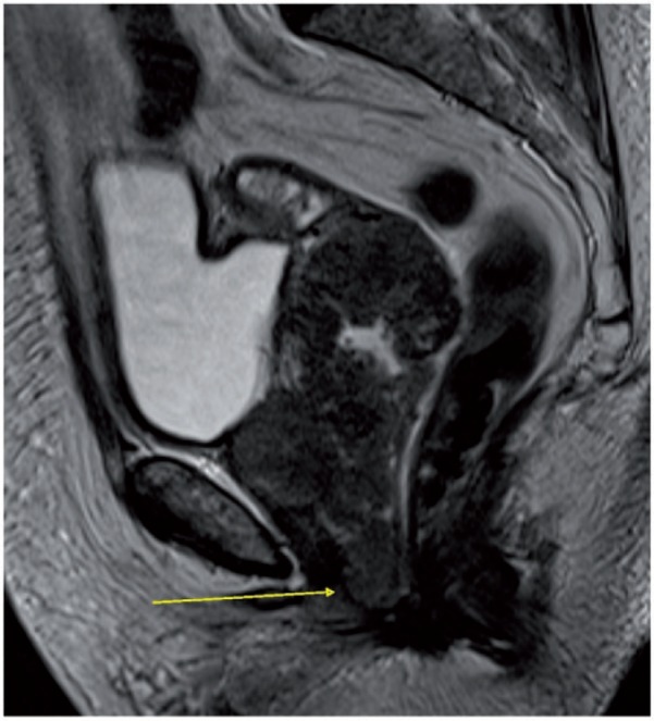 Figure 25