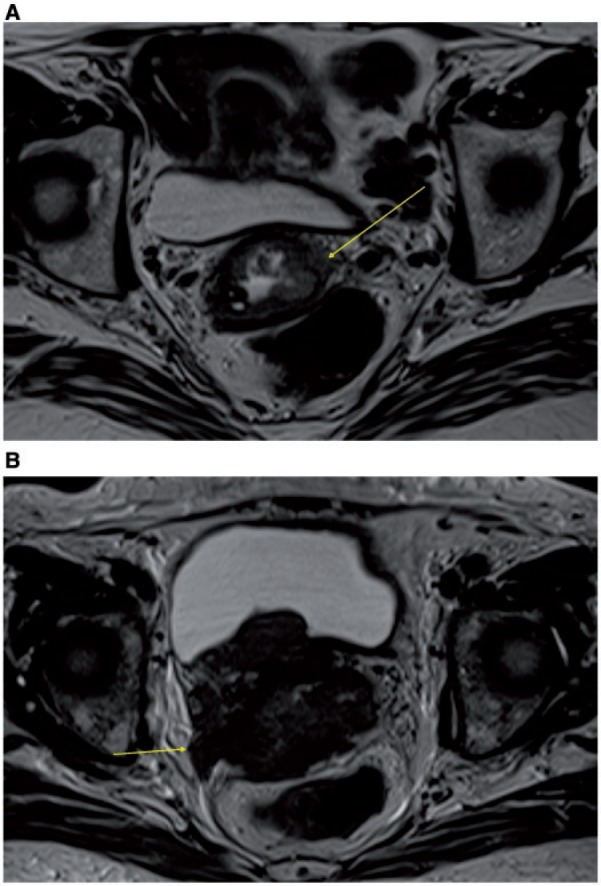 Figure 26