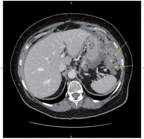 Figure 13