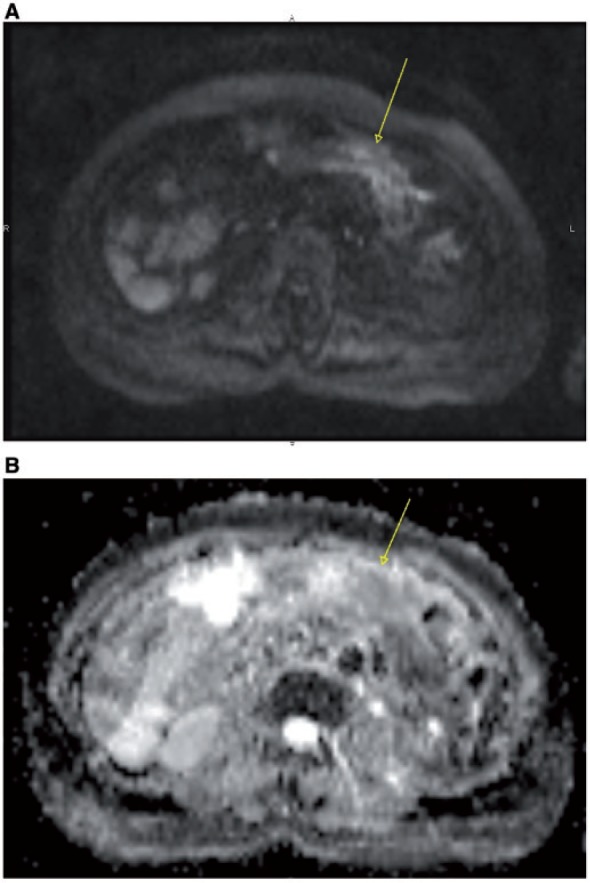 Figure 19