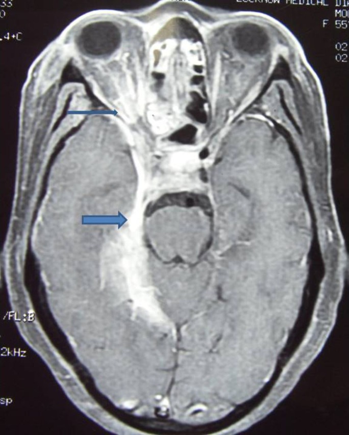 Figure 2