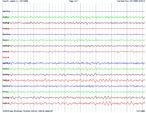 Figure 3.