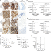 Figure 2. 4C8 selectively stain tumor tissues from several cancers. A, 4C8 antibody, anti-CD44 antibody, and IgG isotype control antibody were used to stain tissue microarrays from pancreatic, breast, prostate, colon, and lung carcinomas. Sections show representative stainings of tumor tissue with anti-CD44v6, 4C8, and adjacent normal tissue with 4C8. B and C, Graphs illustrating the percentage of carcinoma and healthy tissue sections of each tissue type staining positive with 4C8 and non-glycosylated CD44v6. D, Dotplot plotting H-scores of 4C8 staining against CD44v6 staining, individual datapoints colored on the basis of scoring as positive for CD44v6 only (gray), 4C8 only (yellow), or both (black). E, Boxplots showing distribution of 4C8 H-scores within positively scored tumors. F, Odds ratios and 95% confidence intervals for positive 4C8 staining. For cancer grade, odds ratios were calculated compared with grade 1 cancers and were controlled for sex and age. For the cancer stage, odds ratios were calculated compared with stage 1 and were controlled for sex and age. For sex, odds ratios were calculated comparing male with female and were controlled for the grade, stage, and age. For age, odds ratios were controlled for the grade, stage, and sex. *, P < 0.05; **, P < 0.01.