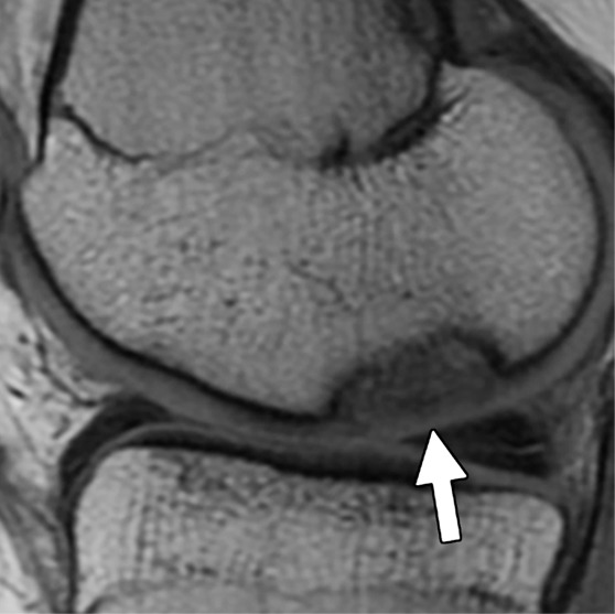 Figure 4a: