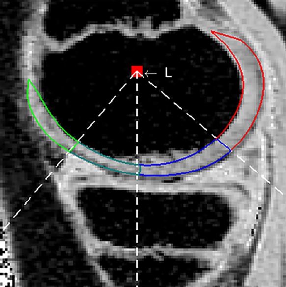 Figure 1c: