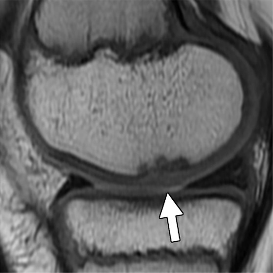 Figure 3a: