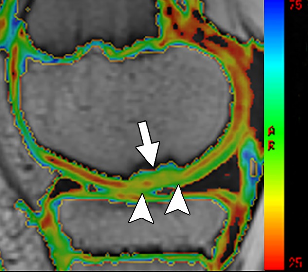 Figure 3c: