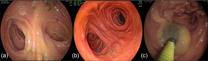 Figure 6.