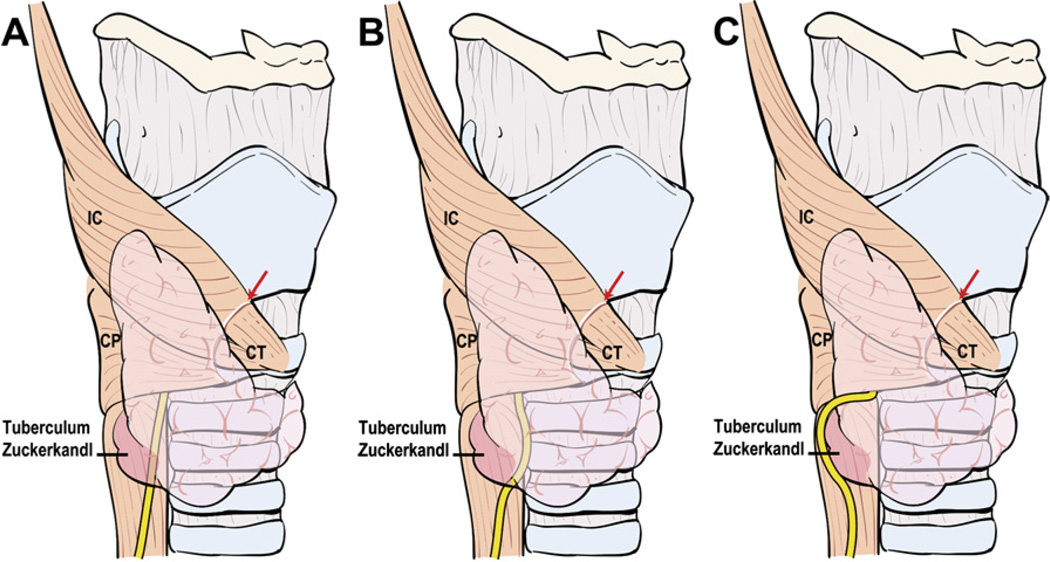 Fig. 10