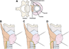 Fig. 11