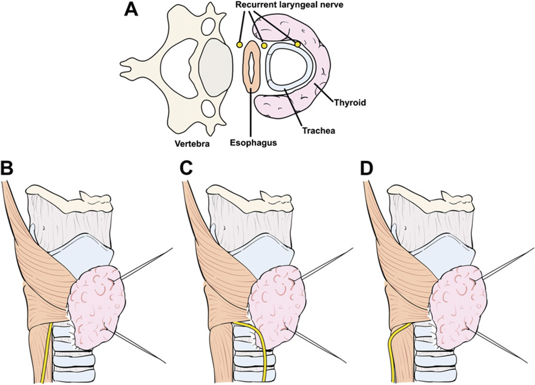 Fig. 11