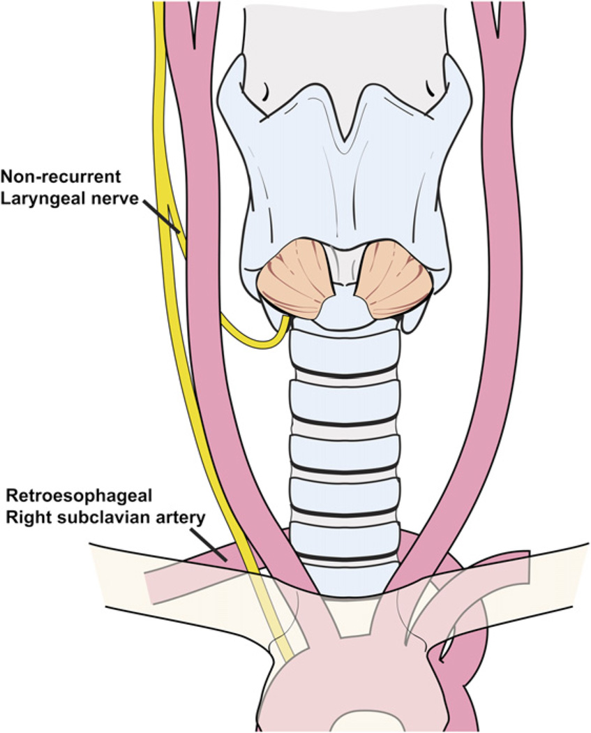 Fig. 15