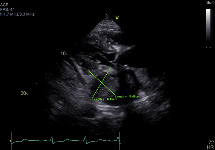 Figure 2