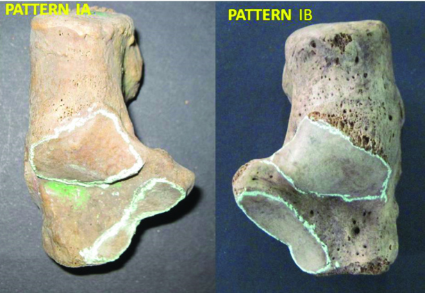 [Table/Fig-4]: