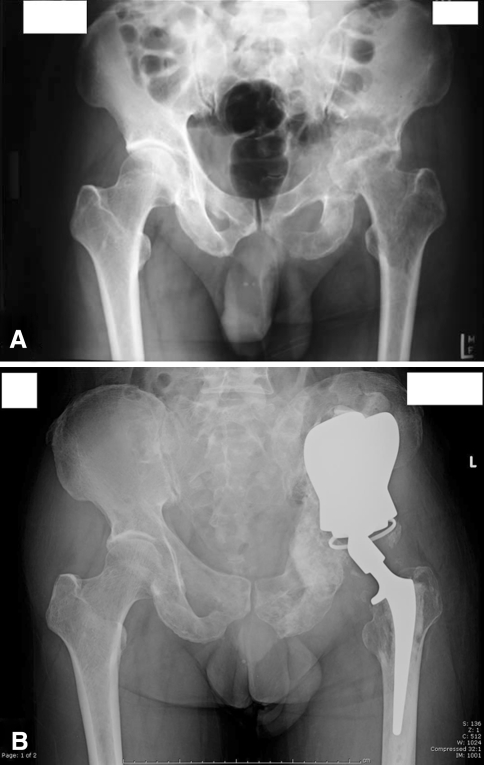 Fig. 2A–B