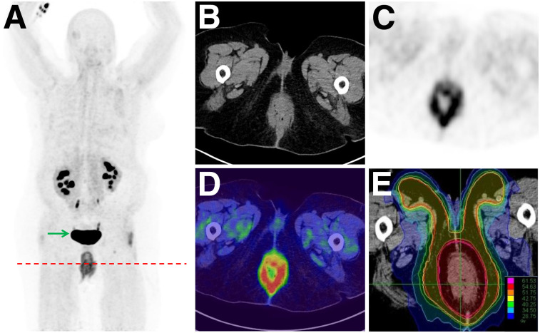 FIGURE 3.