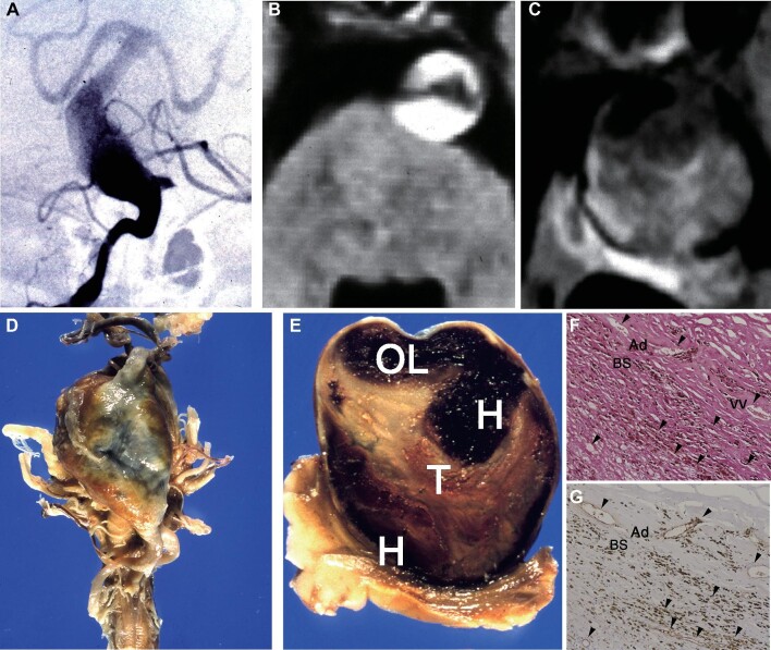 FIGURE 11.