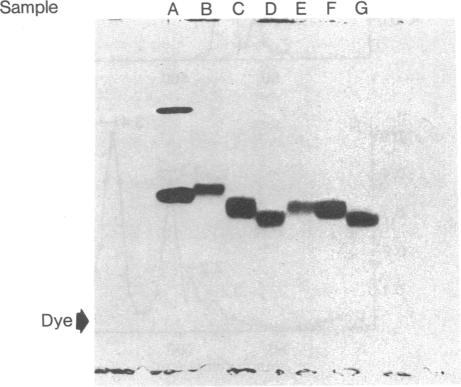 graphic file with name pnas00004-0556-c.jpg