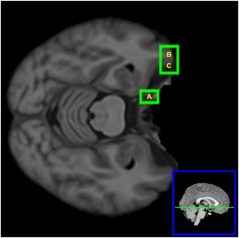 Fig 5