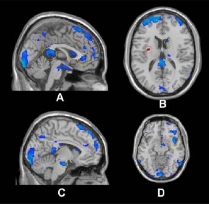 Fig. (1)