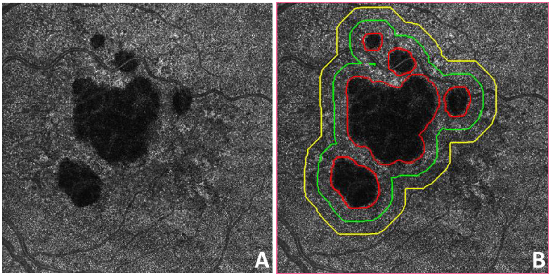 Figure 3: