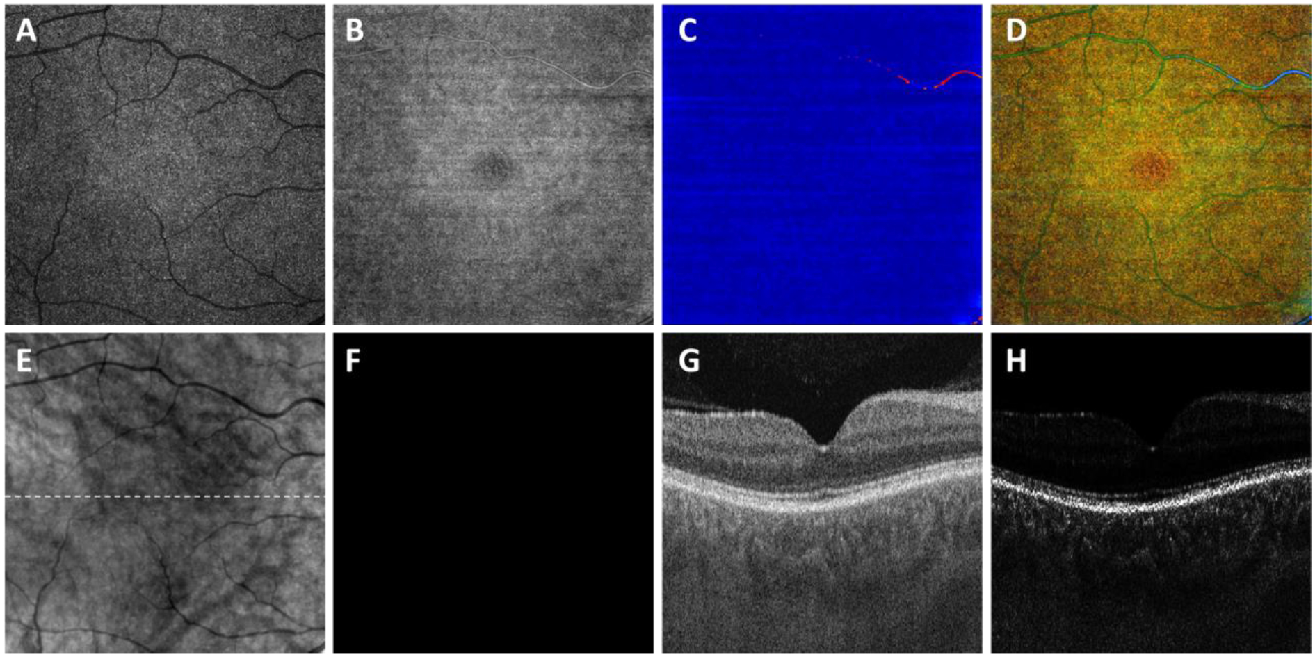 Figure 4: