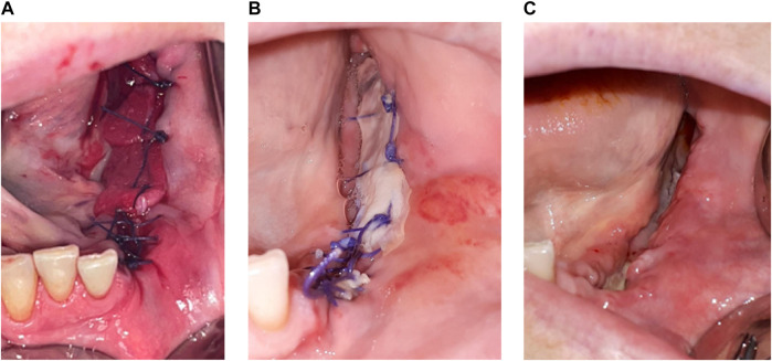 FIGURE 3