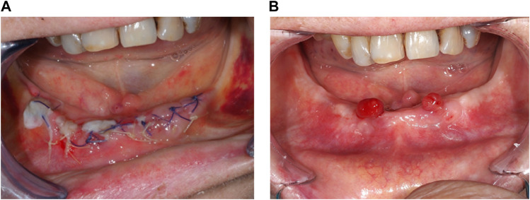 FIGURE 6