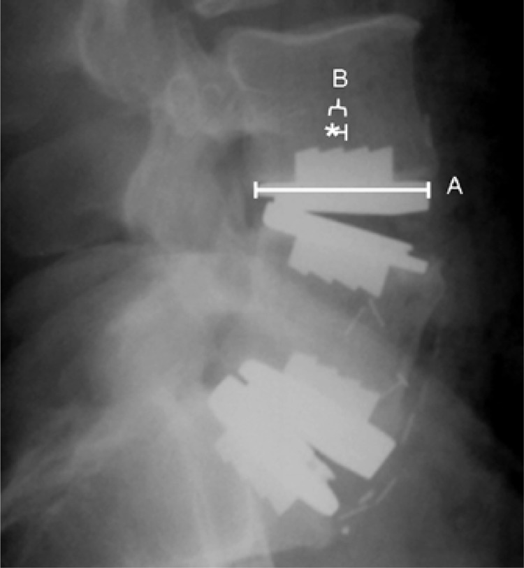 Figure 2B