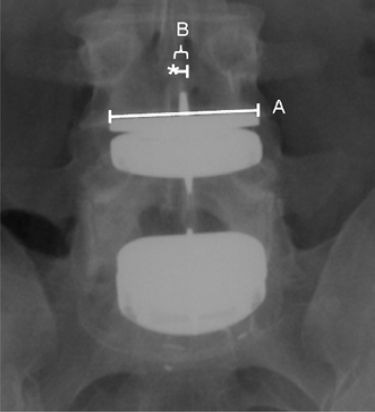 Figure 2A