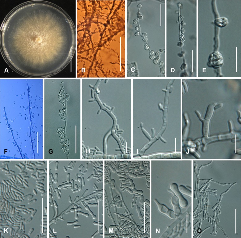 Fig. 92A–O.