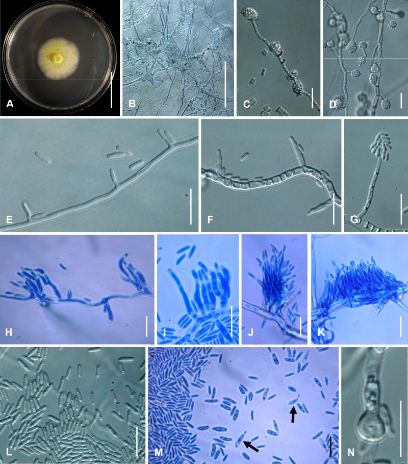 Fig. 108A–N.