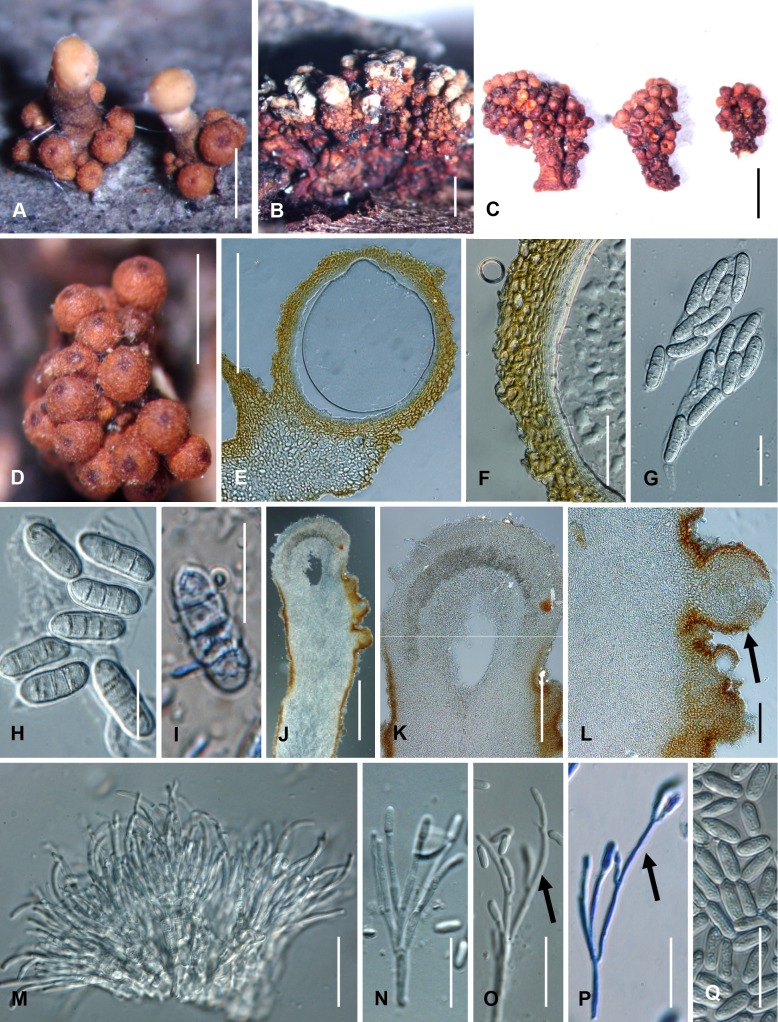 Fig. 26A–Q.