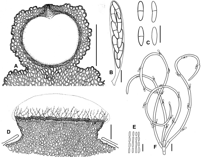 Fig. 14A–F.