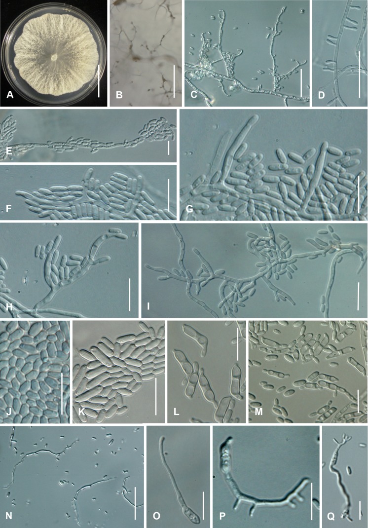 Fig. 52A–Q.