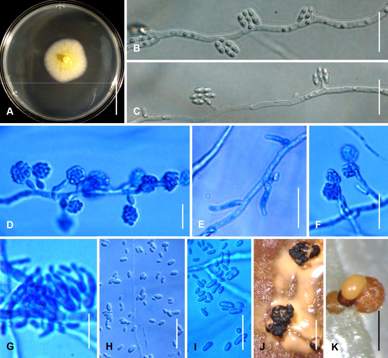 Fig. 86A–K.