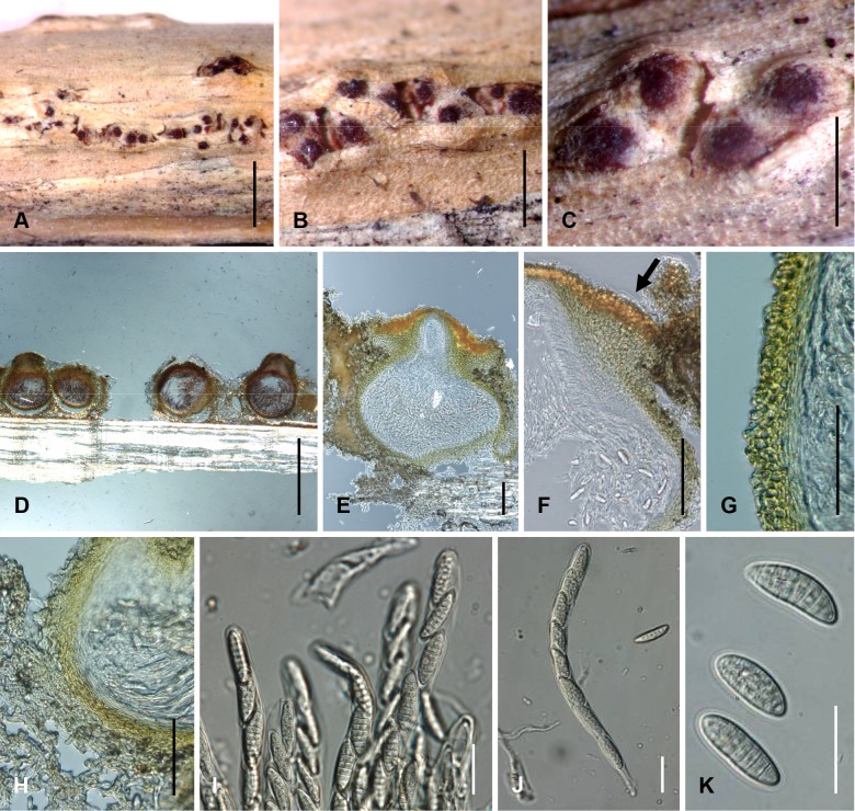 Fig. 112A–K.