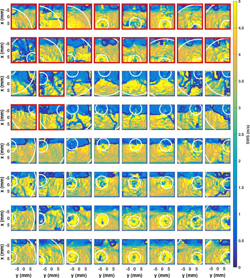 Fig. 15