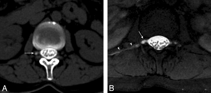 Fig 4.